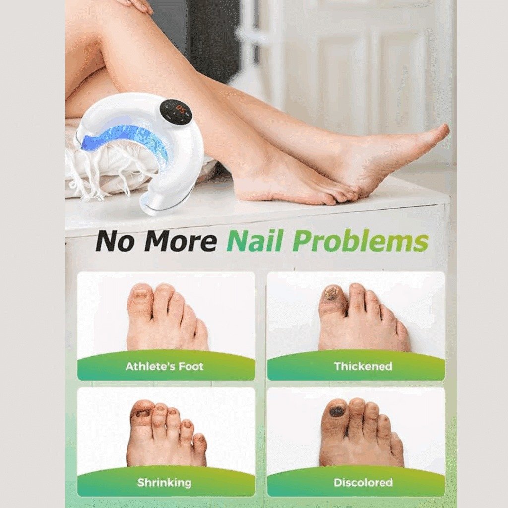 Before and after results showing nail fungus treatment progression